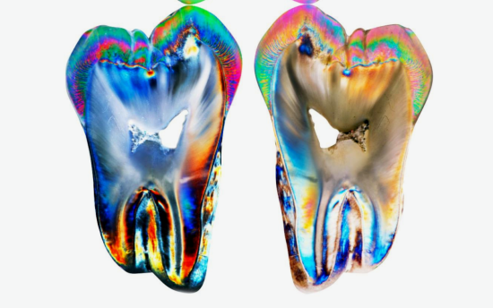tooth morphology biomimetic dentistry biomimetics